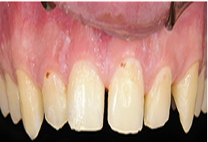 Cosmetic Dental Office in West Chester