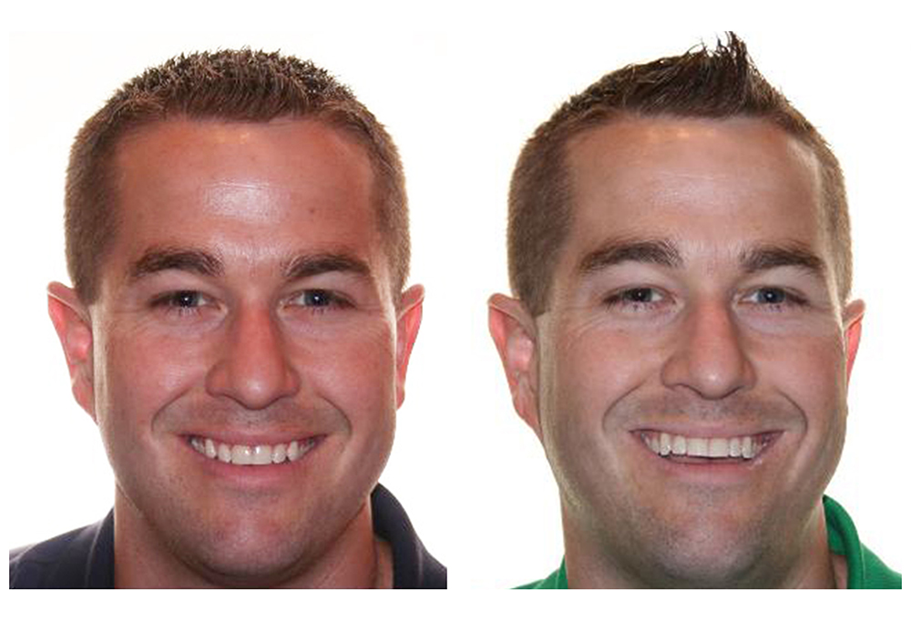 West Chester Dental Smile Center