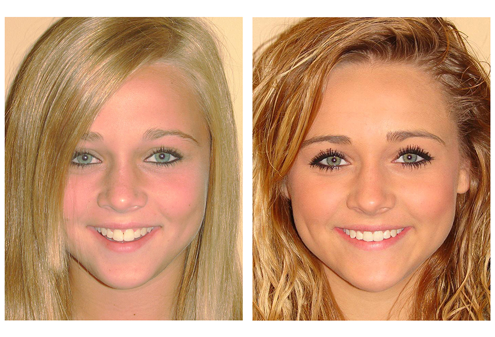 West Chester Dental Smile Center